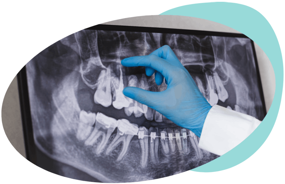 Dental radiology and Diagnostics-Dental Implants center Croatia