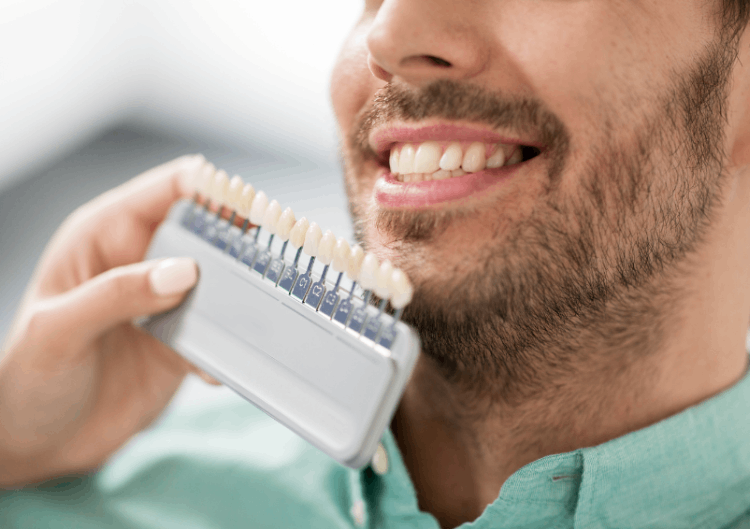 Dental veneers Dental Implants center Croatia